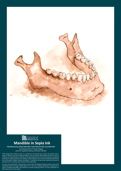 Mandible Mandible