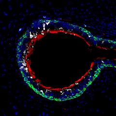 Eustachian Tube