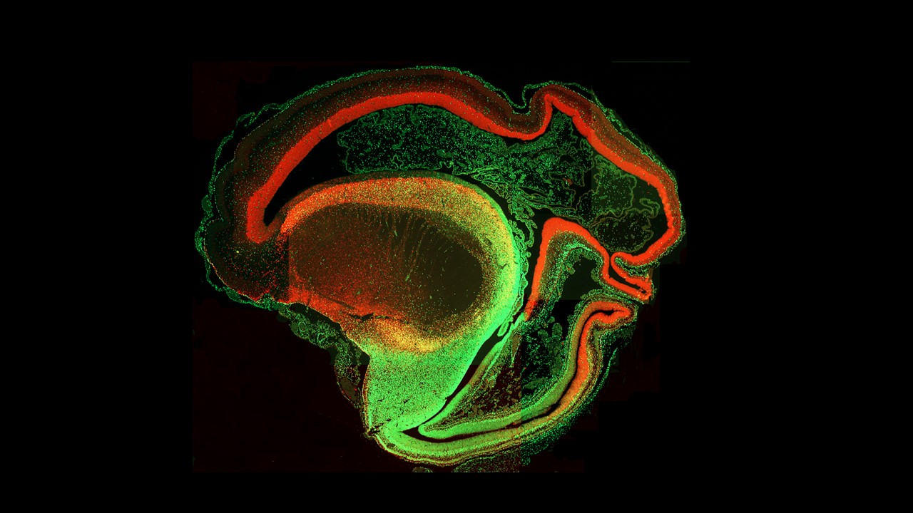 Cerebralcortex