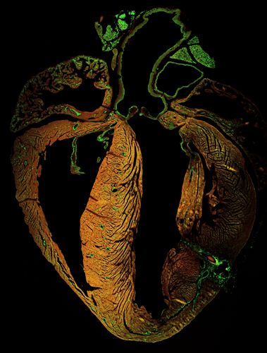 Regenerating Heart.jpg