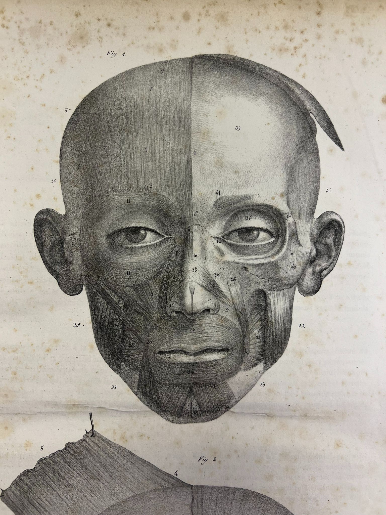 Anatomy Without Dissection II