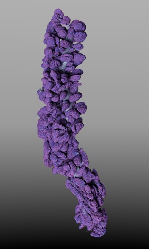 Meibonian Gland.jpg